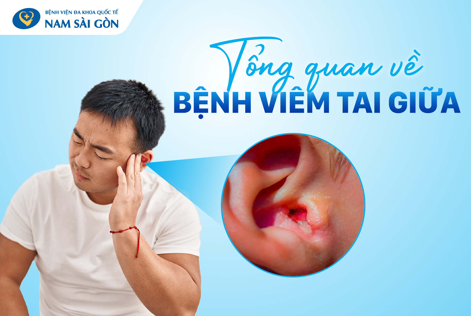 Tổng quan về bệnh viêm tai giữa