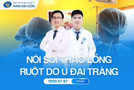 NỘI SOI THÁO LỒNG RUỘT DO U ĐẠI TRÀNG